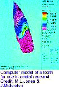 Tooth model [ 37.92 Kb ]