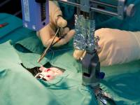 Kirurški zahvat na štakoru u pokusu [ 162.13 Kb ]